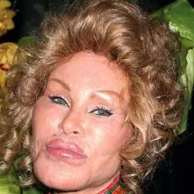 Jocelyn Wildenstein Net Worth 2026: Money, Salary, Bio | CelebsMoney